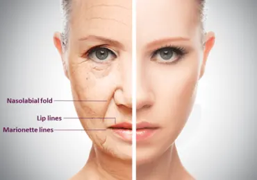 Botulinum and Fillers Botulinum and Fillers