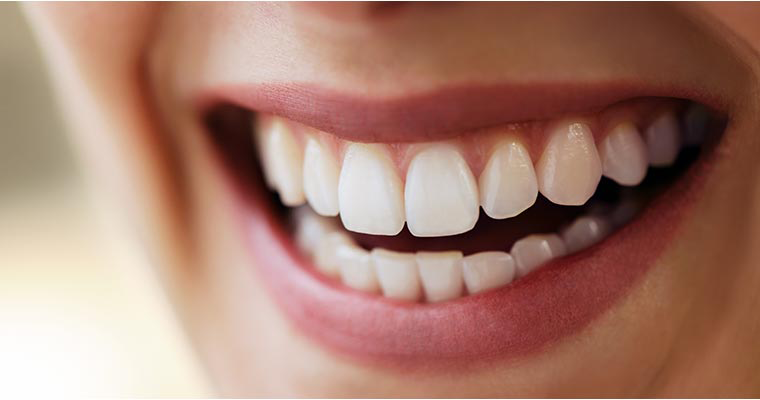 photo of female smile with restored teeth