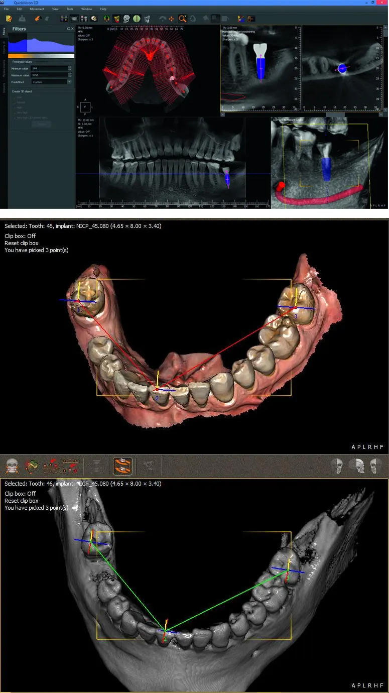 3D IMAGING 3D IMAGING